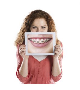 Girl Smiling - Parkway Orthodontics in Sioux Falls, SD