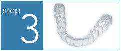 Invisalign step 3 - Parkway Orthodontics in Sioux Falls, SD
