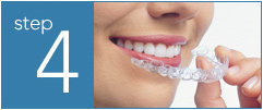 Invisalign step 4 - Parkway Orthodontics in Sioux Falls, SD